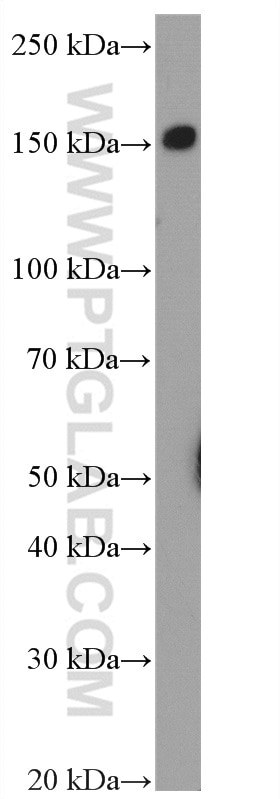 Western Blot (WB) analysis of HL-60 cells using EMR1 Polyclonal antibody (27044-1-AP)