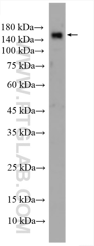 Western Blot (WB) analysis of RAW 264.7 cells using EMR1 Polyclonal antibody (27044-1-AP)