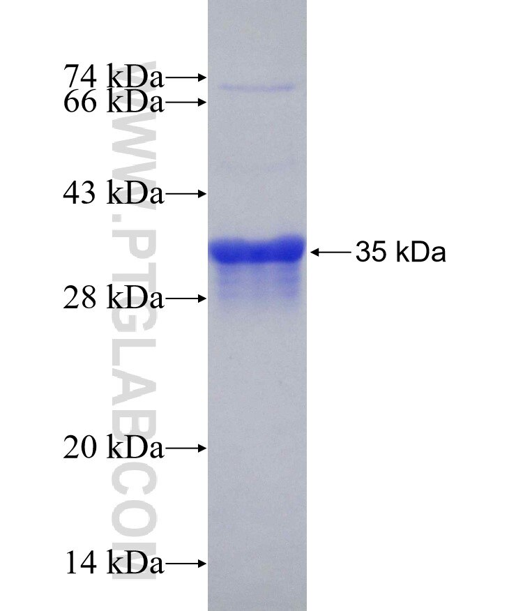 EMR1 fusion protein Ag25883 SDS-PAGE