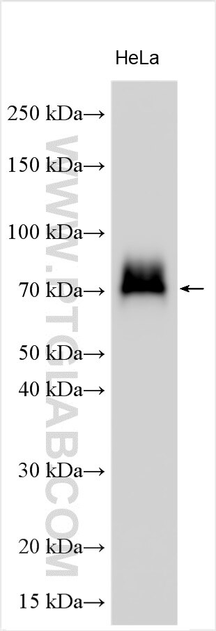 Western Blot (WB) analysis of various lysates using EMR2 Polyclonal antibody (32405-1-AP)