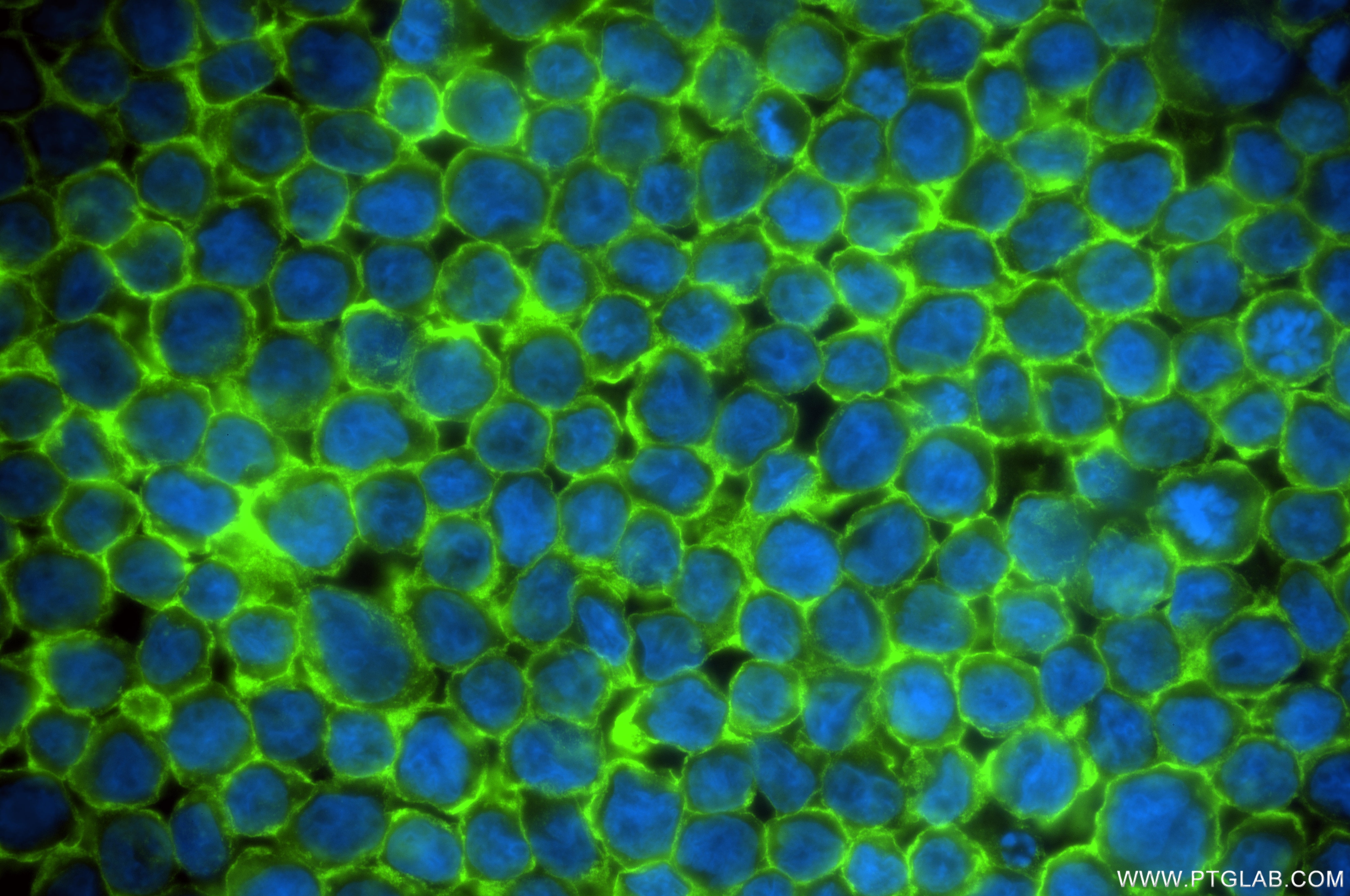 Immunofluorescence (IF) / fluorescent staining of THP-1 cells using EMR2/CD312 Recombinant monoclonal antibody (84608-5-RR)