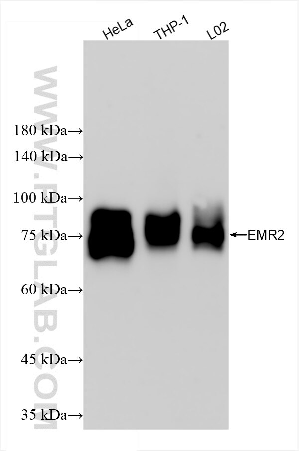 Western Blot (WB) analysis of various lysates using EMR2 Recombinant antibody (84608-5-RR)