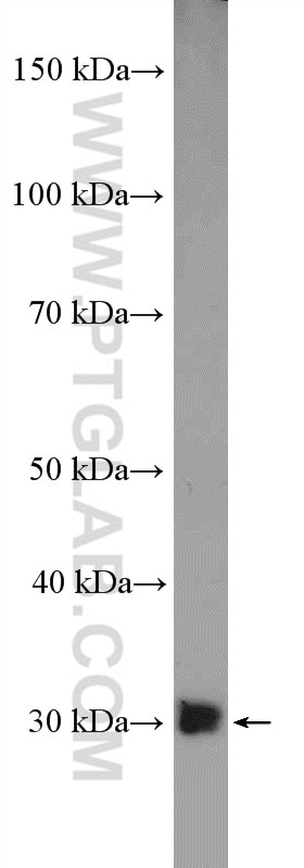 WB analysis of mouse brain using 55032-1-AP