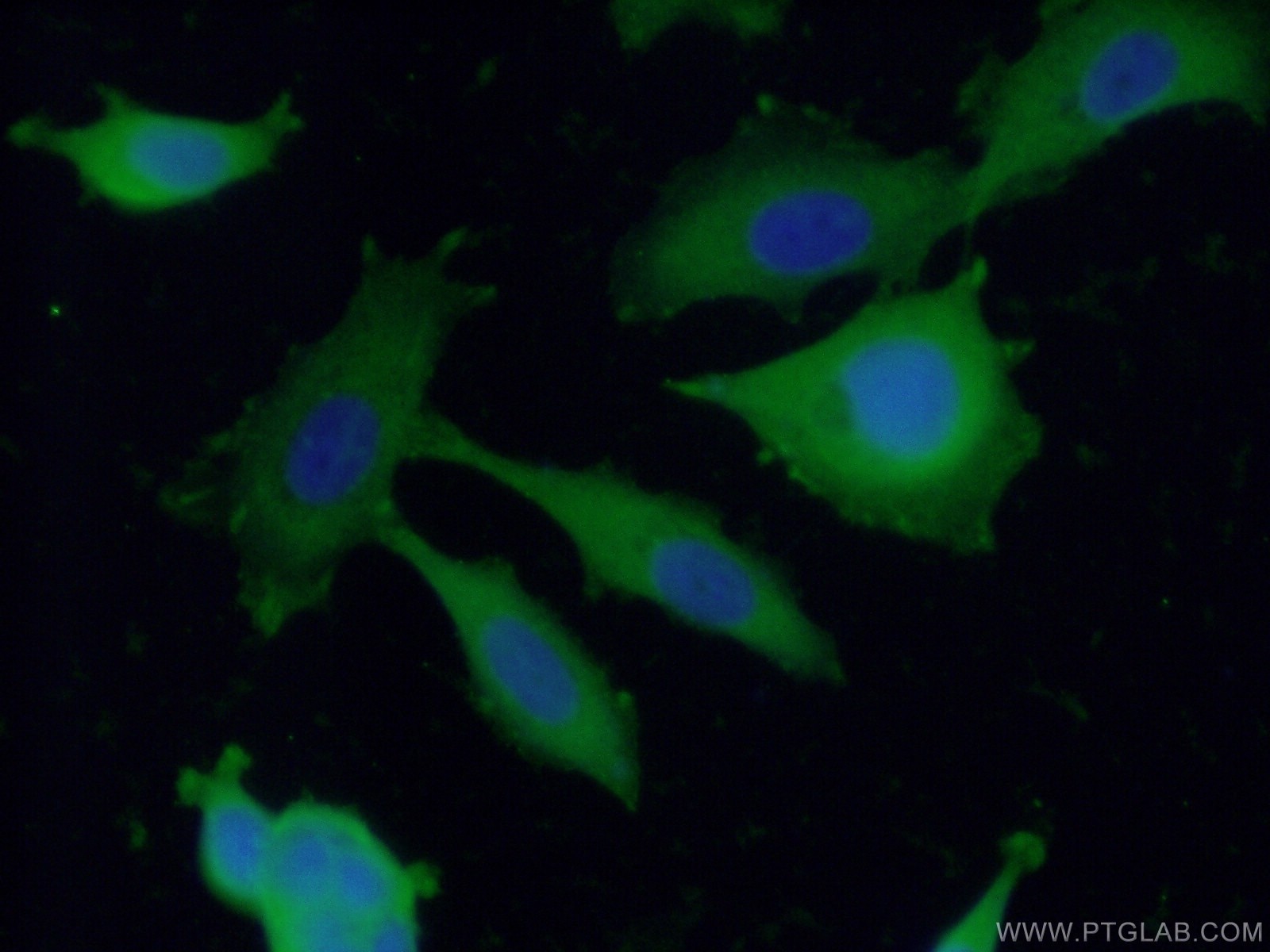 Immunofluorescence (IF) / fluorescent staining of MCF-7 cells using ENAH Polyclonal antibody (26421-1-AP)