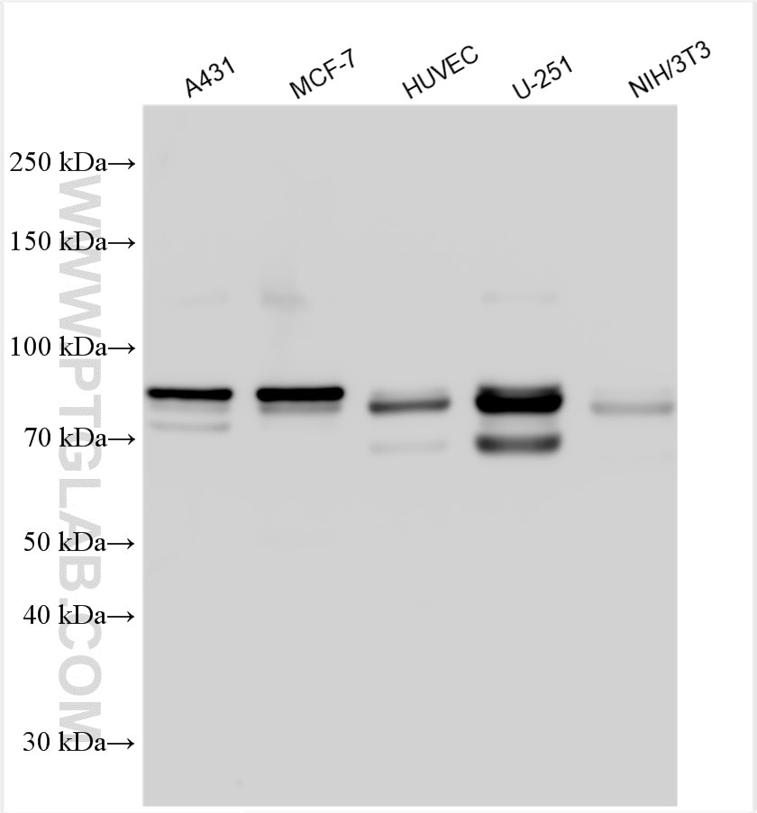 Western Blot (WB) analysis of various lysates using ENAH Polyclonal antibody (26421-1-AP)
