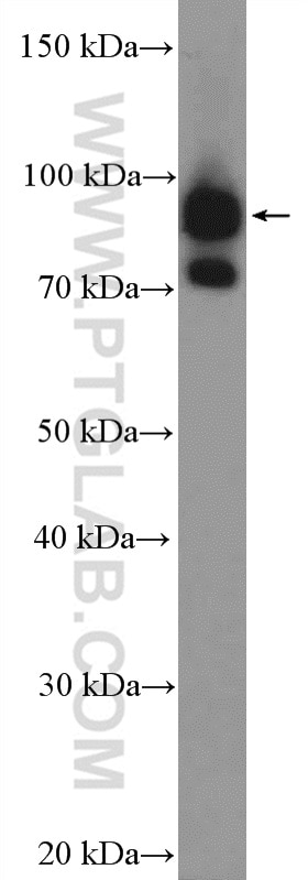 Western Blot (WB) analysis of U-251 cells using ENAH Polyclonal antibody (26421-1-AP)