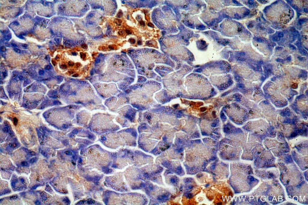 Immunohistochemistry (IHC) staining of human pancreas tissue using ENC1 Polyclonal antibody (15007-1-AP)