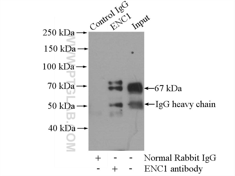 Immunoprecipitation (IP) experiment of mouse brain tissue using ENC1 Polyclonal antibody (15007-1-AP)