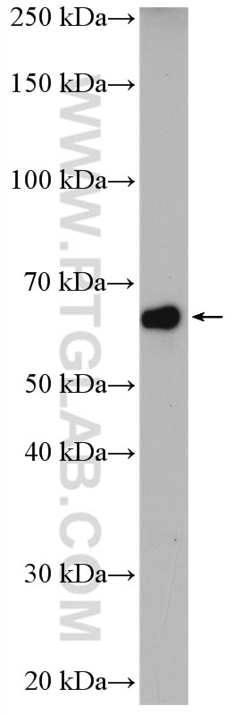 Western Blot (WB) analysis of SH-SY5Y cells using ENC1 Polyclonal antibody (15007-1-AP)