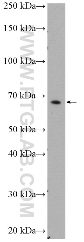 Western Blot (WB) analysis of Neuro-2a cells using ENC1 Polyclonal antibody (15007-1-AP)