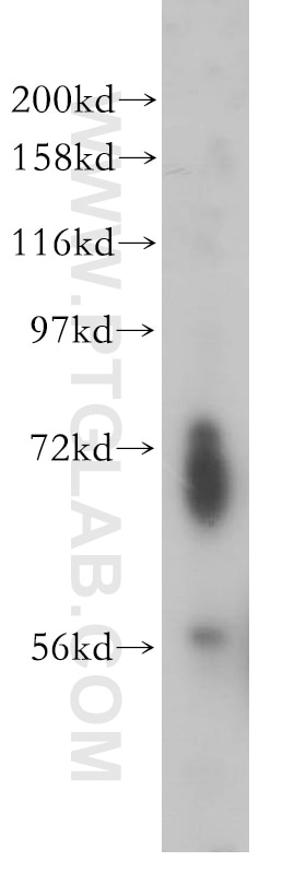 Western Blot (WB) analysis of MCF-7 cells using ENC1 Polyclonal antibody (15007-1-AP)