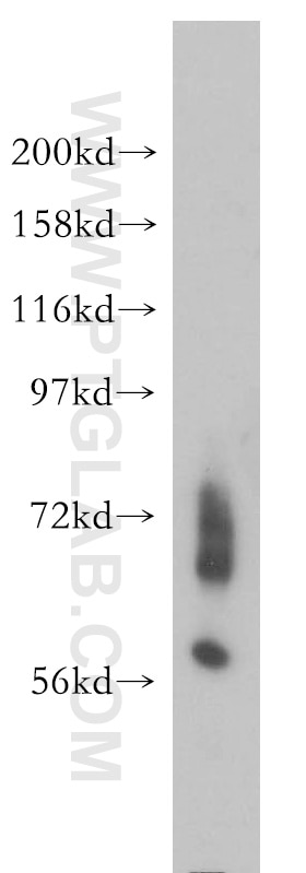Western Blot (WB) analysis of mouse brain tissue using ENC1 Polyclonal antibody (15007-1-AP)