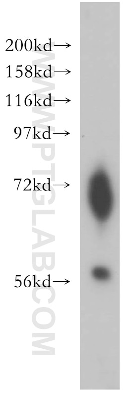 Western Blot (WB) analysis of human lung tissue using ENC1 Polyclonal antibody (15007-1-AP)