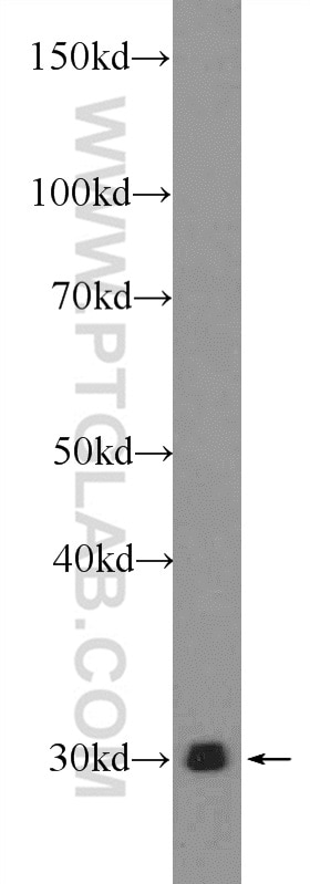 Western Blot (WB) analysis of rat kidney tissue using ENDOG Polyclonal antibody (22148-1-AP)
