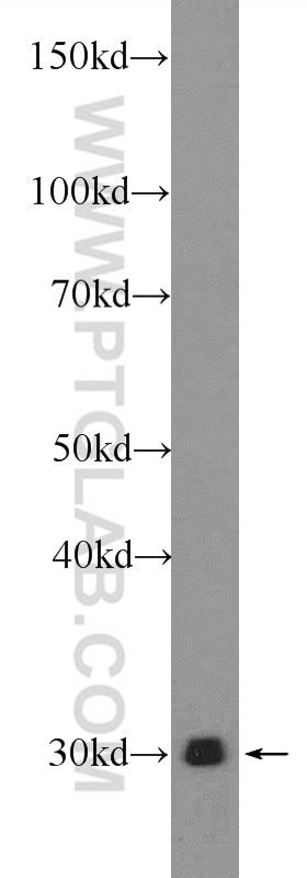 WB analysis of rat kidney using 22148-1-AP