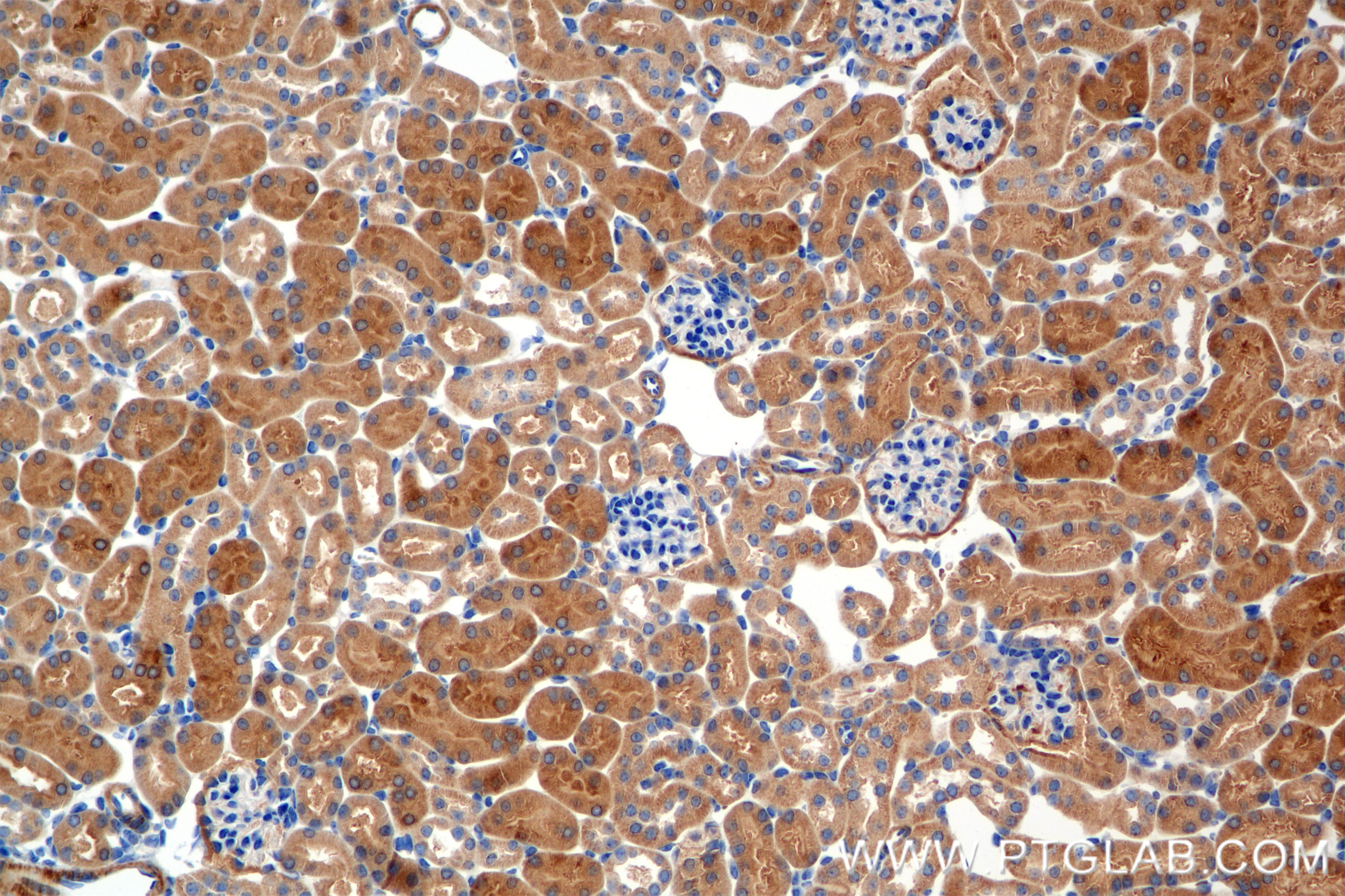 Immunohistochemistry (IHC) staining of mouse kidney tissue using ENDOG Recombinant antibody (86122-1-RR)
