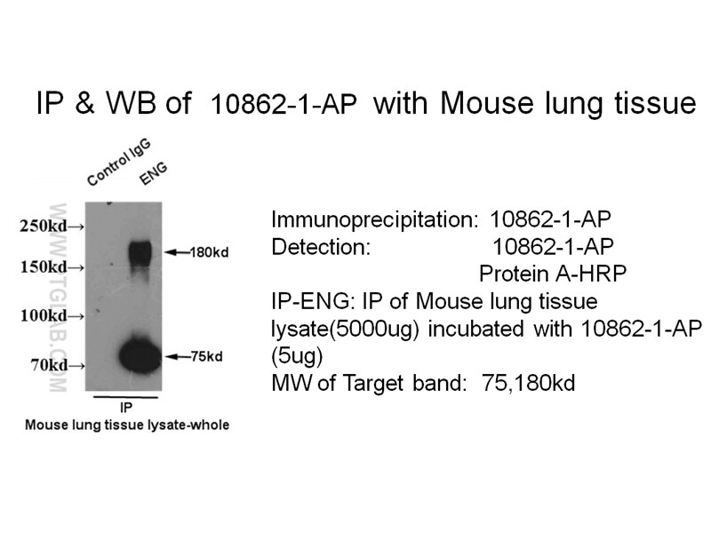 Endoglin/CD105