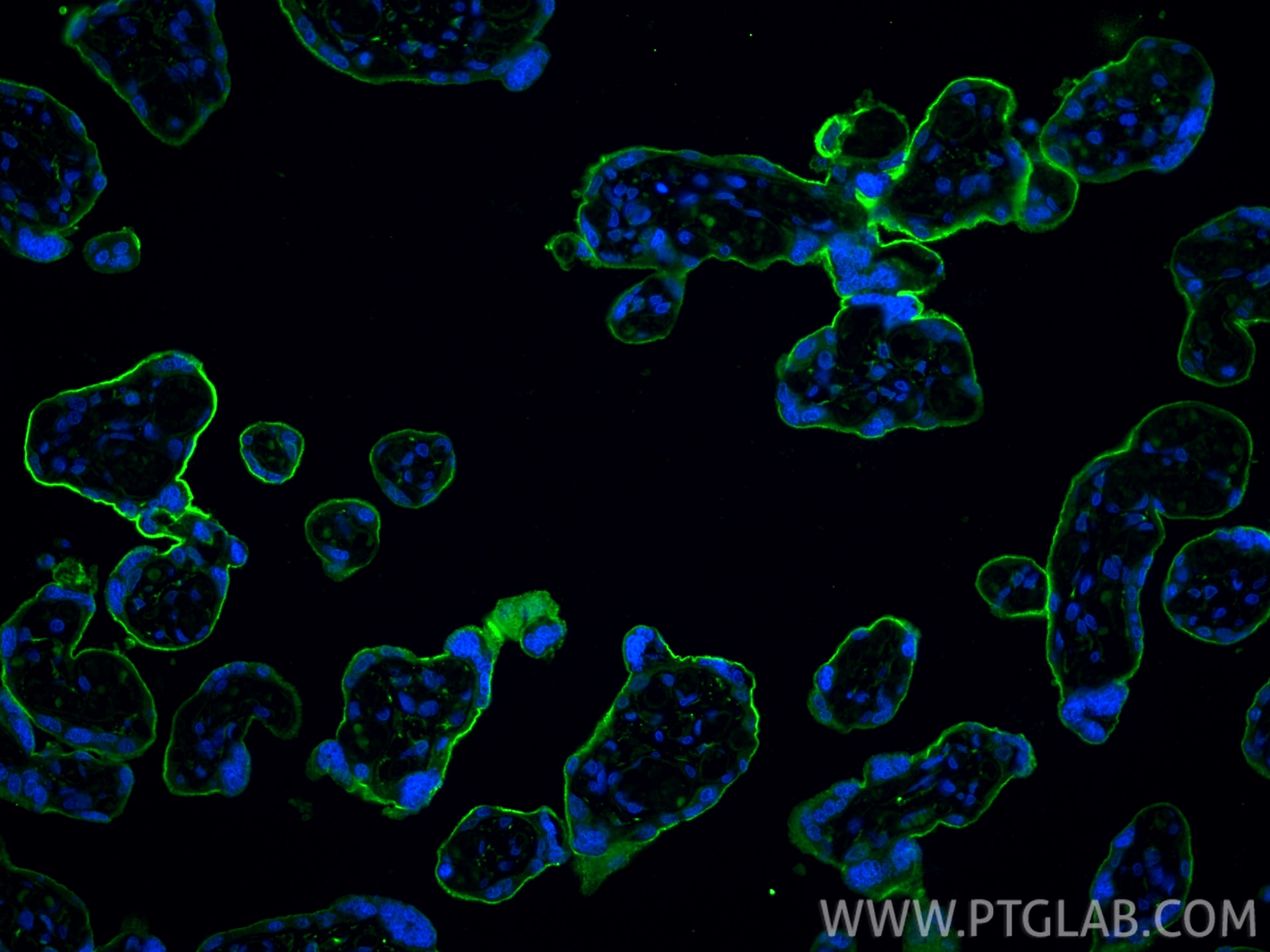Immunofluorescence (IF) / fluorescent staining of human placenta tissue using Endoglin/CD105 Polyclonal antibody (10862-1-AP)