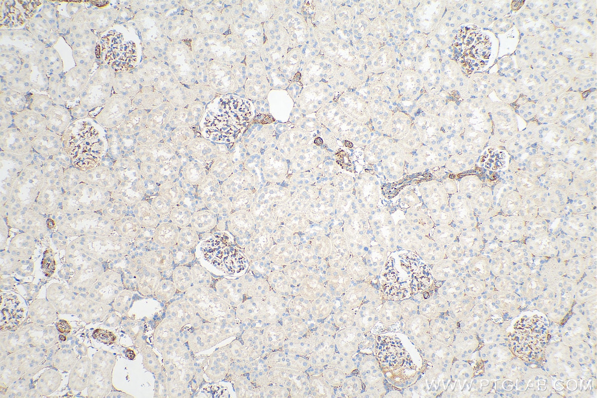 Immunohistochemistry (IHC) staining of rat kidney tissue using Endoglin/CD105 Polyclonal antibody (10862-1-AP)