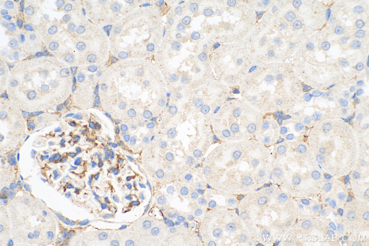 Immunohistochemistry (IHC) staining of rat kidney tissue using Endoglin/CD105 Polyclonal antibody (10862-1-AP)
