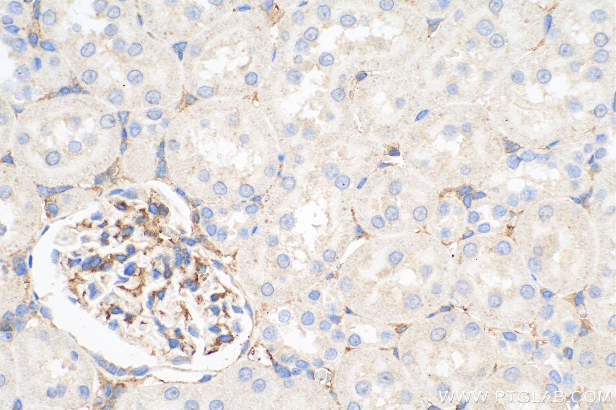 IHC staining of rat kidney using 10862-1-AP