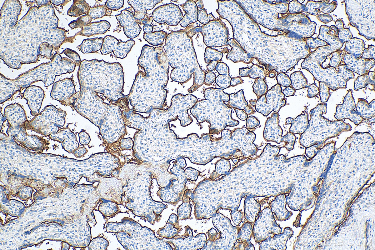 IHC staining of human placenta using 10862-1-AP