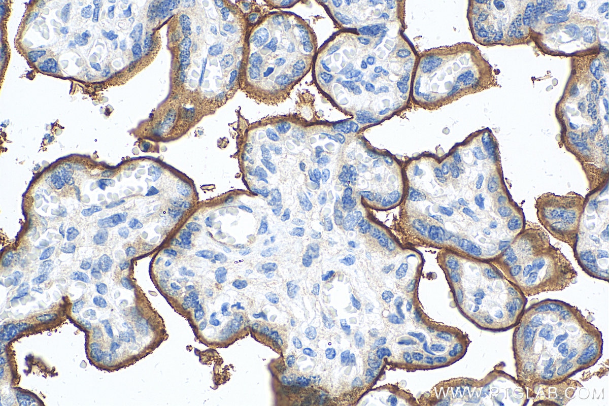 Immunohistochemistry (IHC) staining of human placenta tissue using Endoglin/CD105 Polyclonal antibody (10862-1-AP)