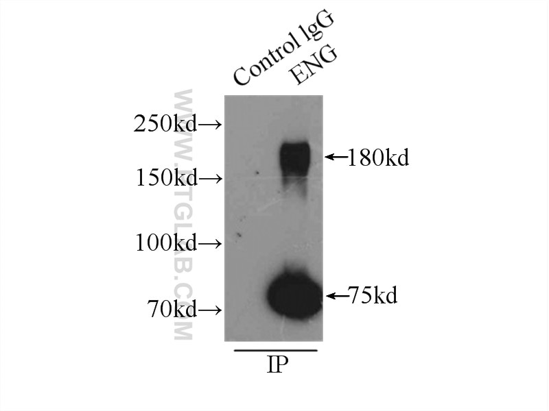 Immunoprecipitation (IP) experiment of mouse lung tissue using Endoglin/CD105 Polyclonal antibody (10862-1-AP)