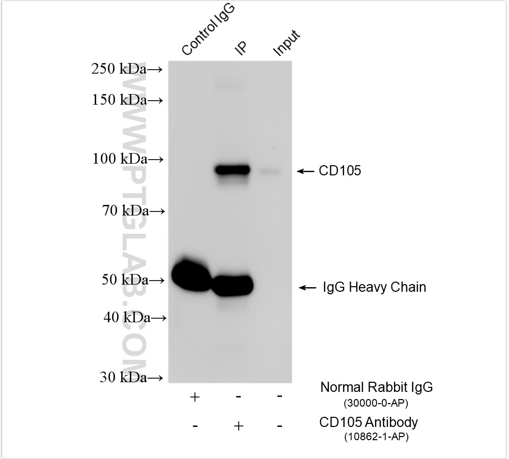 Immunoprecipitation (IP) experiment of mouse lung tissue using Endoglin/CD105 Polyclonal antibody (10862-1-AP)