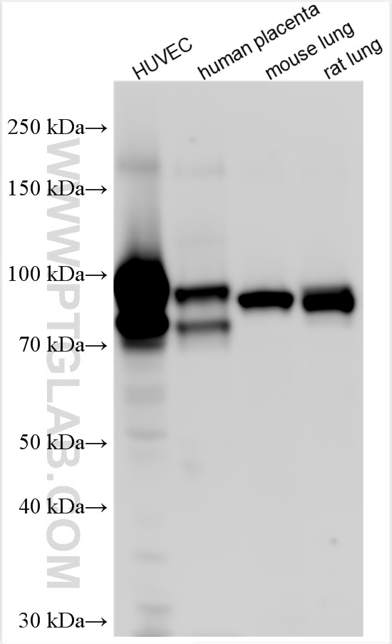 Western Blot (WB) analysis of various lysates using Endoglin/CD105 Polyclonal antibody (10862-1-AP)