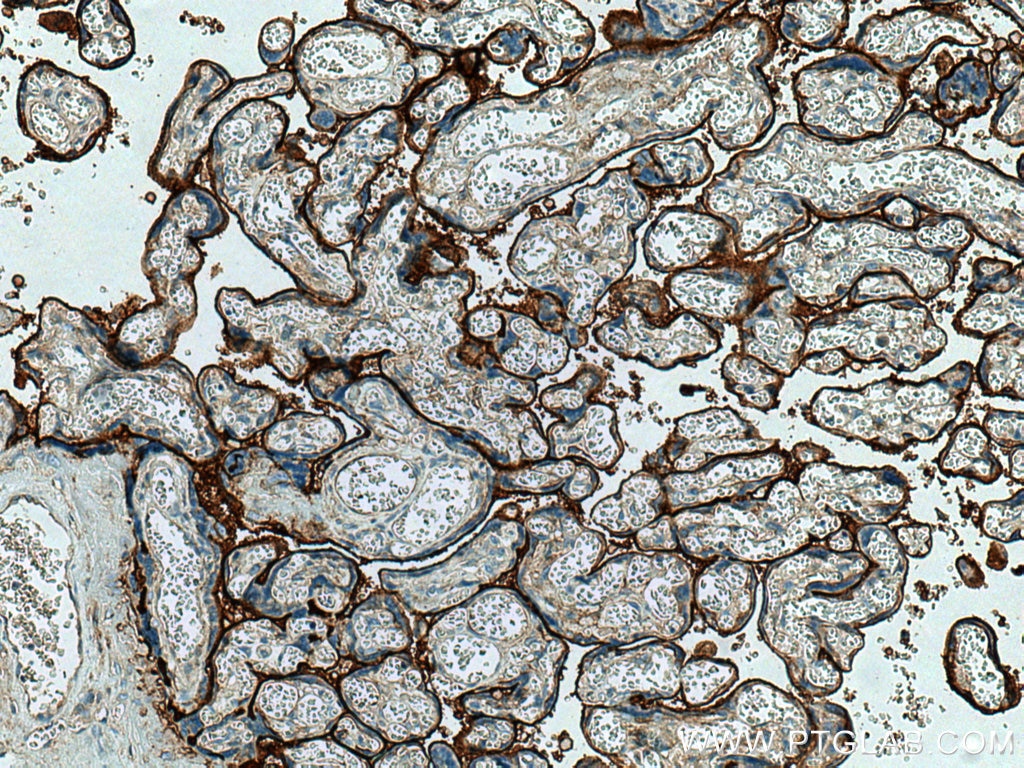 Immunohistochemistry (IHC) staining of human placenta tissue using Endoglin/CD105 Polyclonal antibody (28117-1-AP)