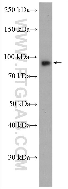 Western Blot (WB) analysis of HUVEC cells using Endoglin/CD105 Polyclonal antibody (28117-1-AP)