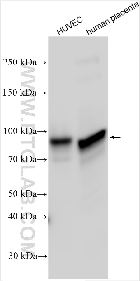 Western Blot (WB) analysis of various lysates using Endoglin/CD105 Polyclonal antibody (28117-1-AP)