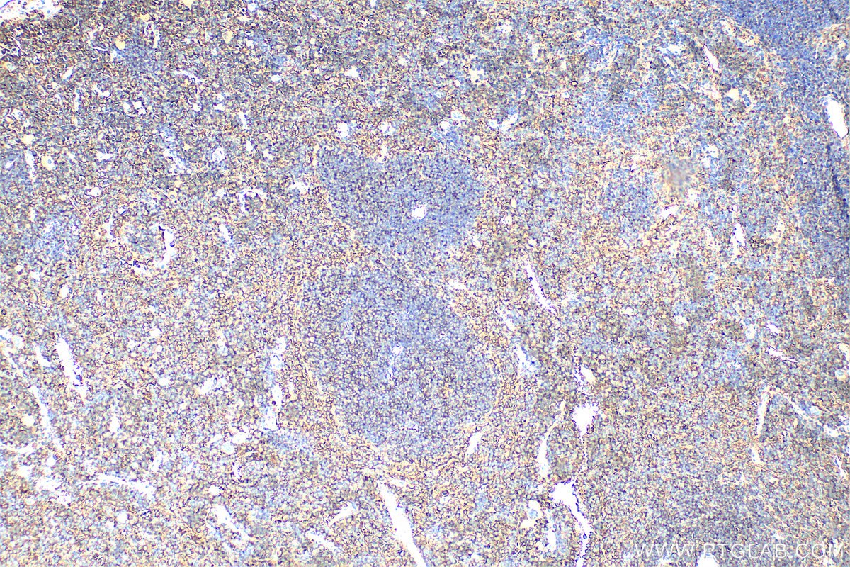 Immunohistochemistry (IHC) staining of mouse spleen tissue using ENGASE Polyclonal antibody (31784-1-AP)
