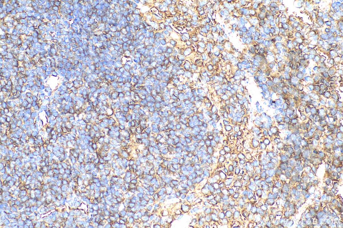 Immunohistochemistry (IHC) staining of mouse spleen tissue using ENGASE Polyclonal antibody (31784-1-AP)
