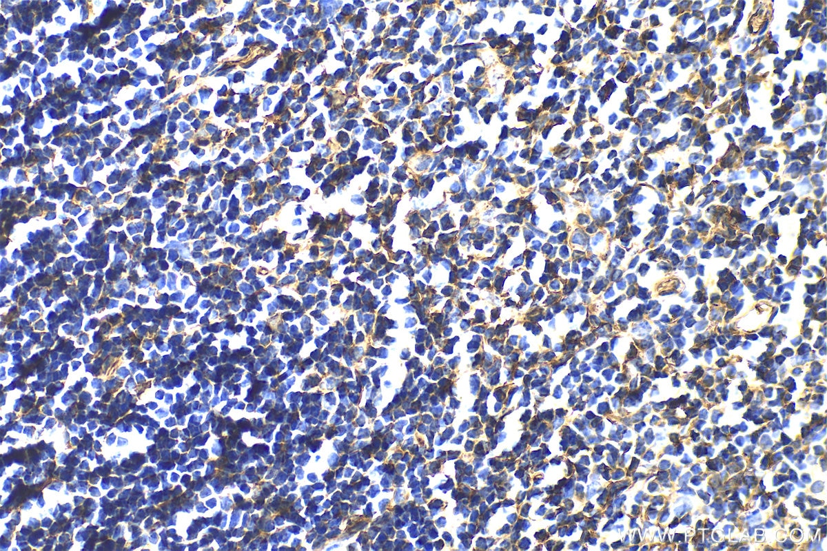 Immunohistochemistry (IHC) staining of mouse thymus tissue using ENGASE Polyclonal antibody (31784-1-AP)