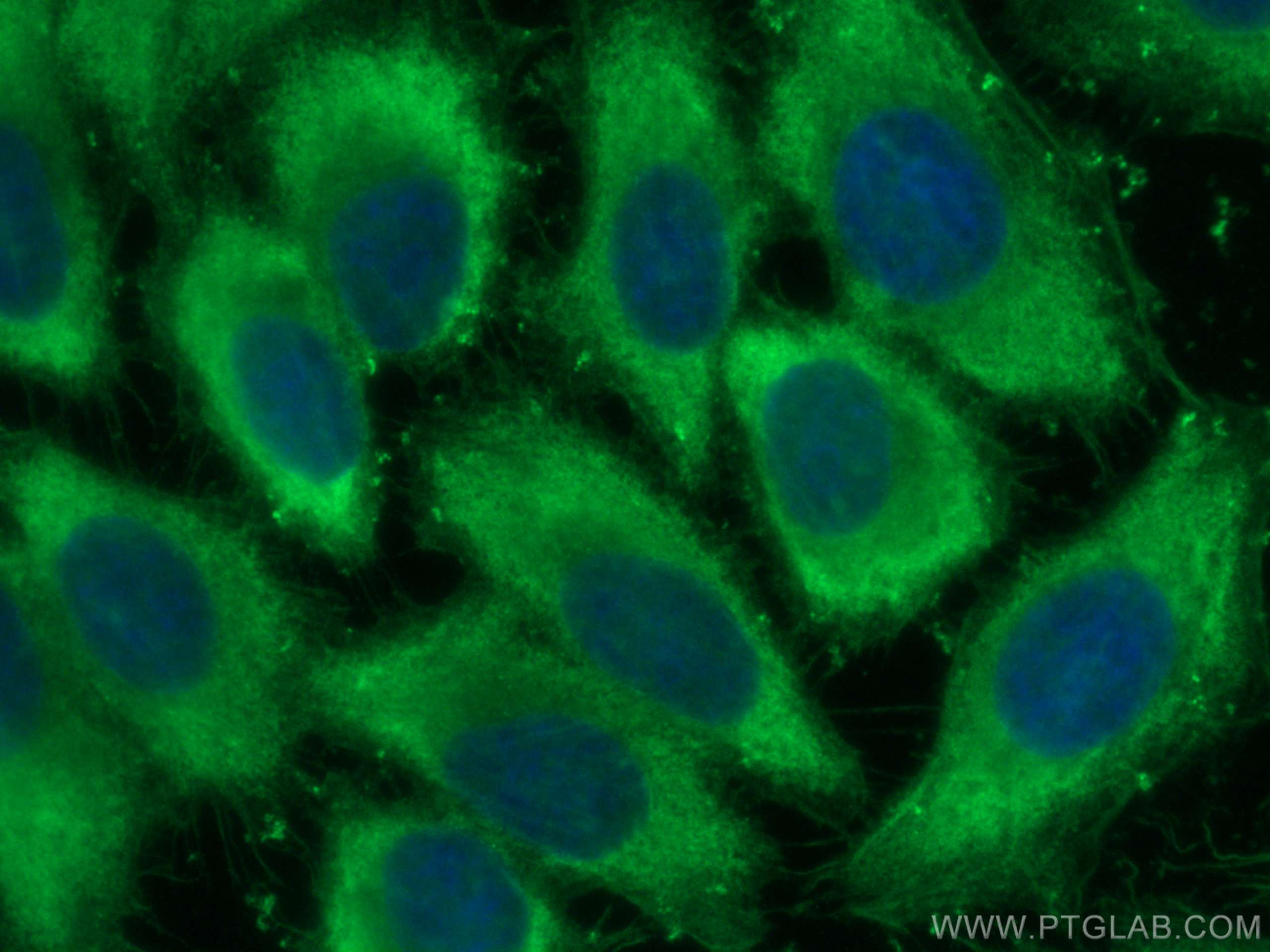 Immunofluorescence (IF) / fluorescent staining of HepG2 cells using ENO1/2/3 Recombinant antibody (81504-1-RR)