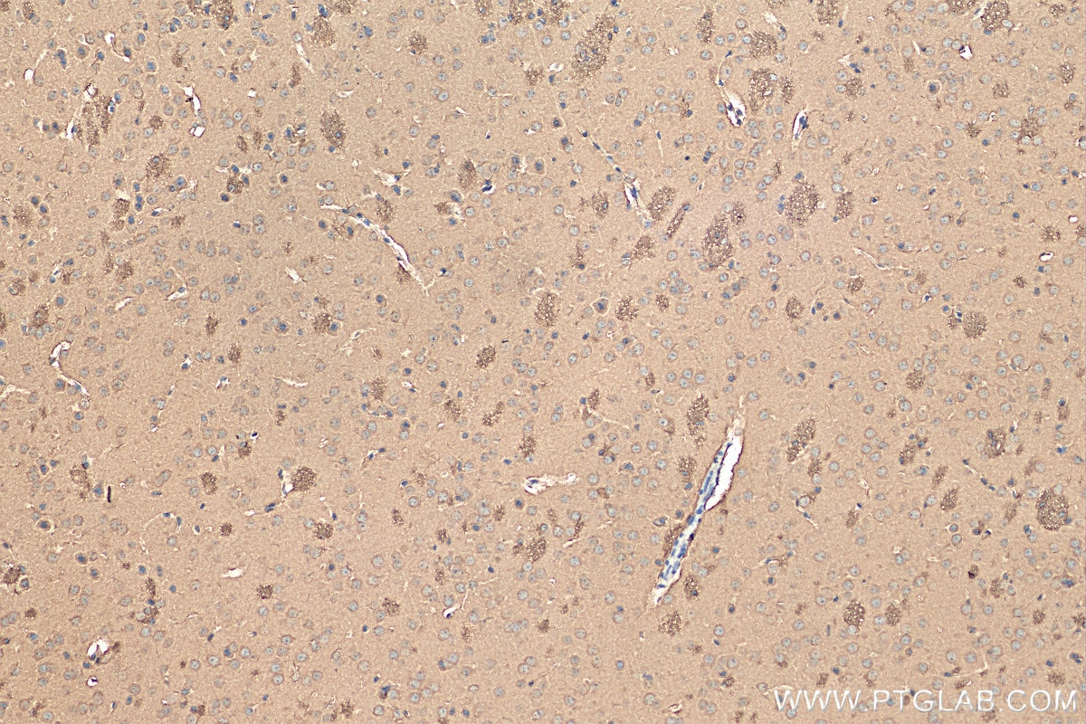 Immunohistochemistry (IHC) staining of mouse brain tissue using ENO1/2/3 Recombinant antibody (81504-1-RR)