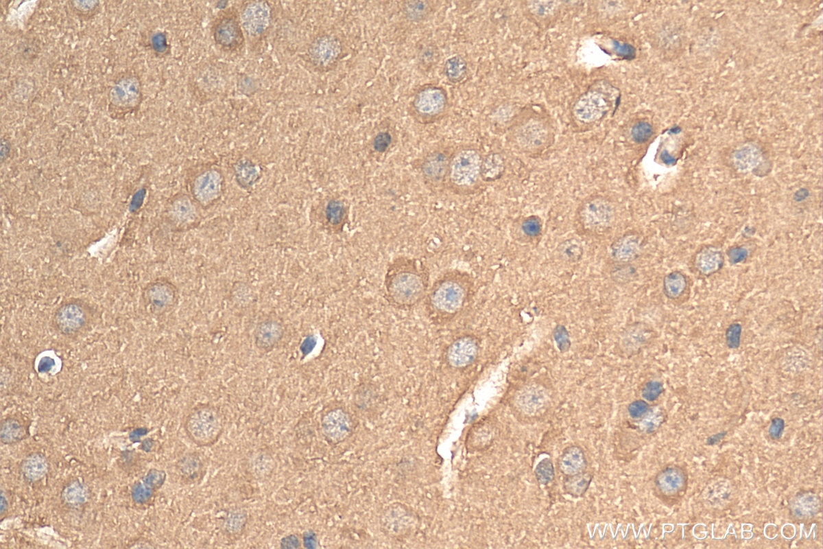 Immunohistochemistry (IHC) staining of mouse brain tissue using ENO1/2/3 Recombinant antibody (81504-1-RR)