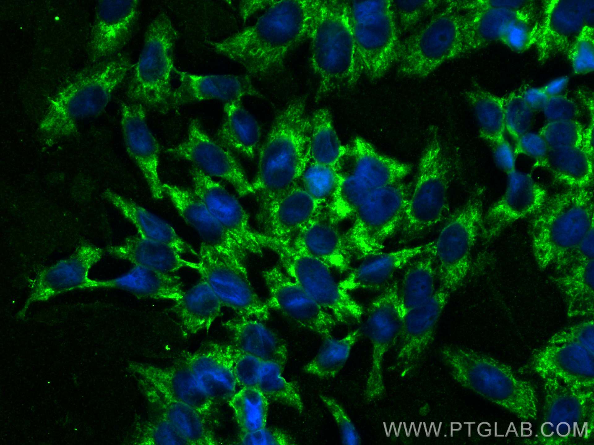 Immunofluorescence (IF) / fluorescent staining of HepG2 cells using CoraLite® Plus 488-conjugated ENO1/2/3 Recombinant (CL488-81504)