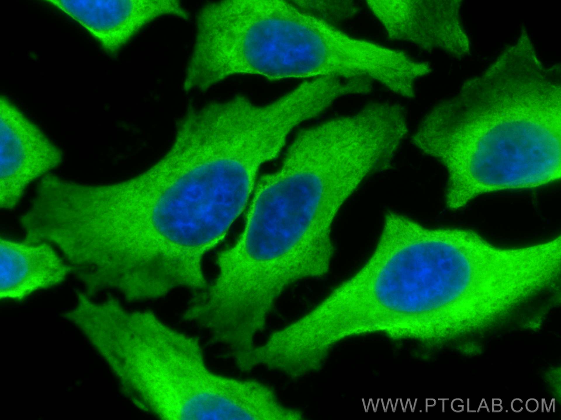 Immunofluorescence (IF) / fluorescent staining of HepG2 cells using ENO1 Polyclonal antibody (11204-1-AP)