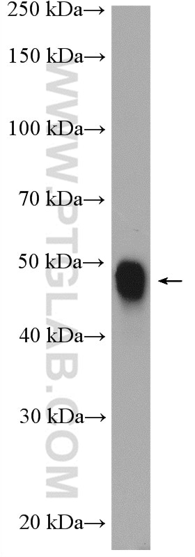 WB analysis of mouse skeletal muscle using 11204-1-AP