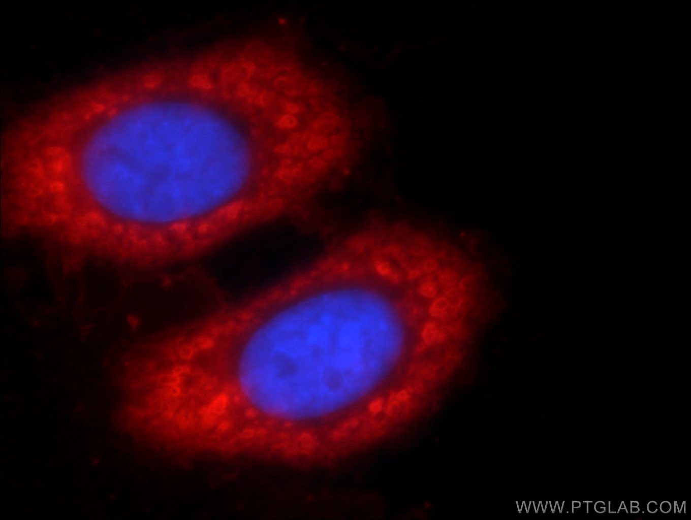 Immunofluorescence (IF) / fluorescent staining of HepG2 cells using ENO1 Polyclonal antibody (55237-1-AP)