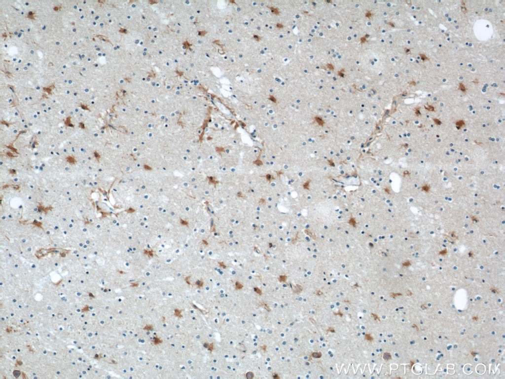 Immunohistochemistry (IHC) staining of human brain tissue using ENO1 Polyclonal antibody (55237-1-AP)