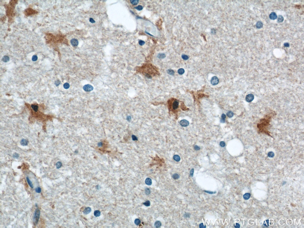 Immunohistochemistry (IHC) staining of human brain tissue using ENO1 Polyclonal antibody (55237-1-AP)