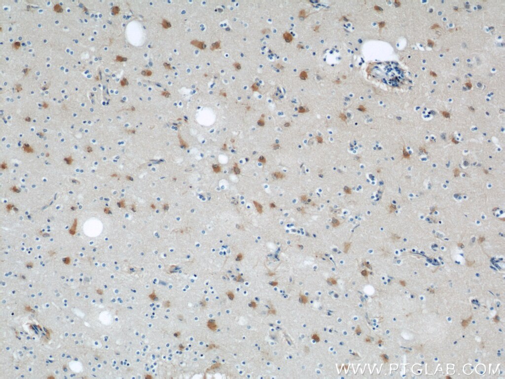 Immunohistochemistry (IHC) staining of human brain tissue using ENO1 Polyclonal antibody (55237-1-AP)