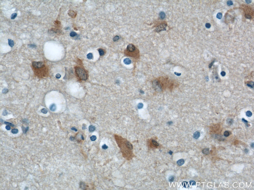 Immunohistochemistry (IHC) staining of human brain tissue using ENO1 Polyclonal antibody (55237-1-AP)