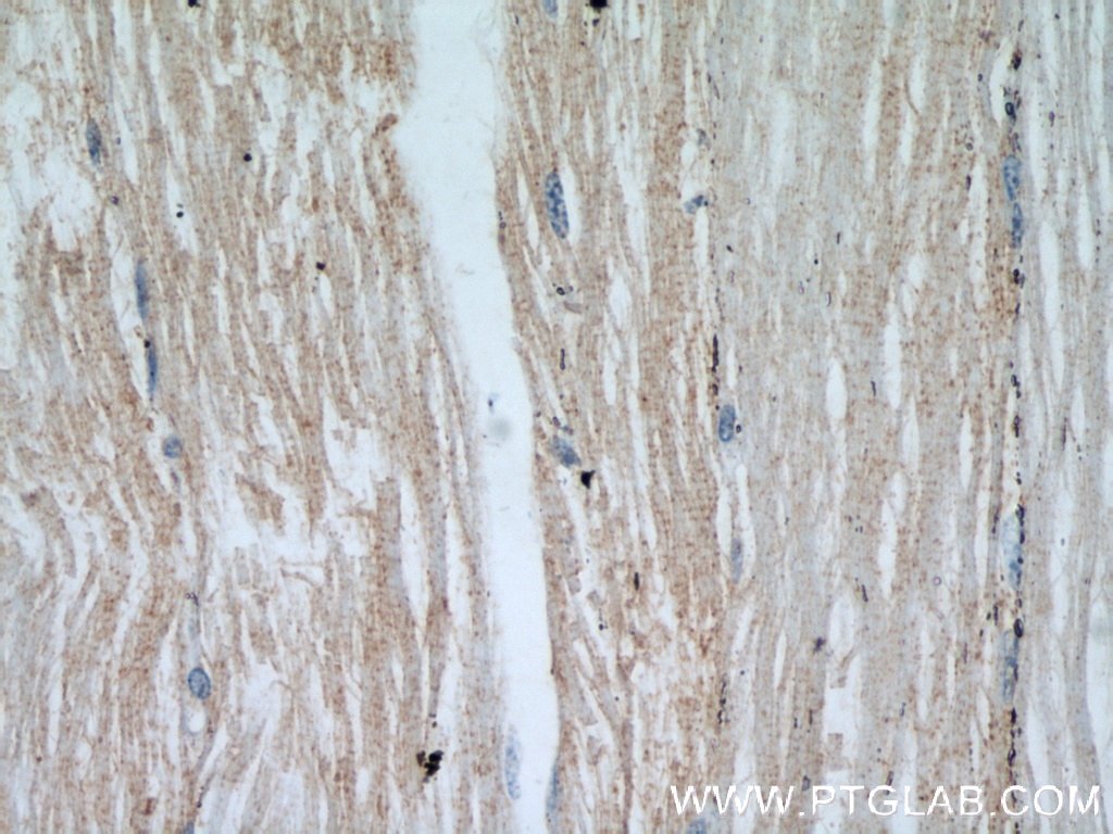 Immunohistochemistry (IHC) staining of human skeletal muscle tissue using ENO1 Polyclonal antibody (55237-1-AP)