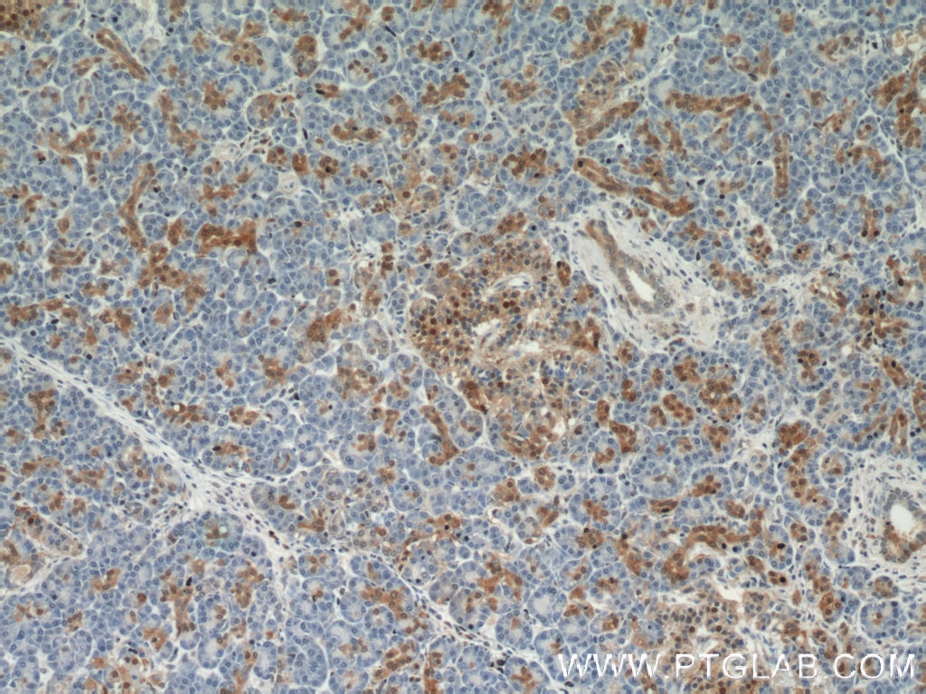 IHC staining of human pancreas using 55237-1-AP