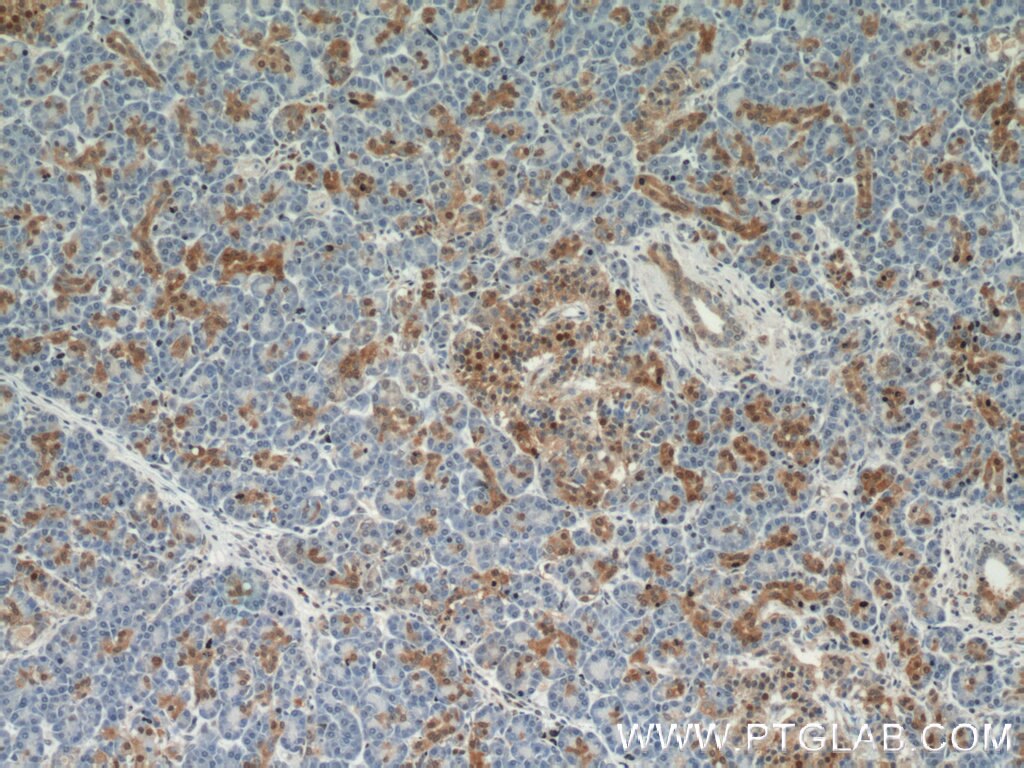 Immunohistochemistry (IHC) staining of human pancreas tissue using ENO1 Polyclonal antibody (55237-1-AP)